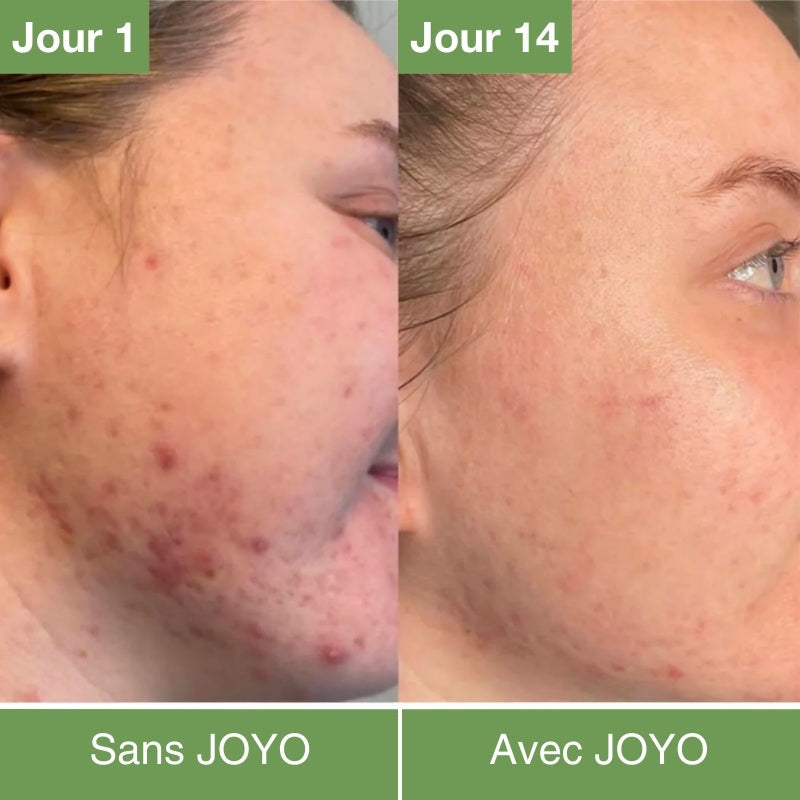 Masque LED Anti-âge & Rajeunissement