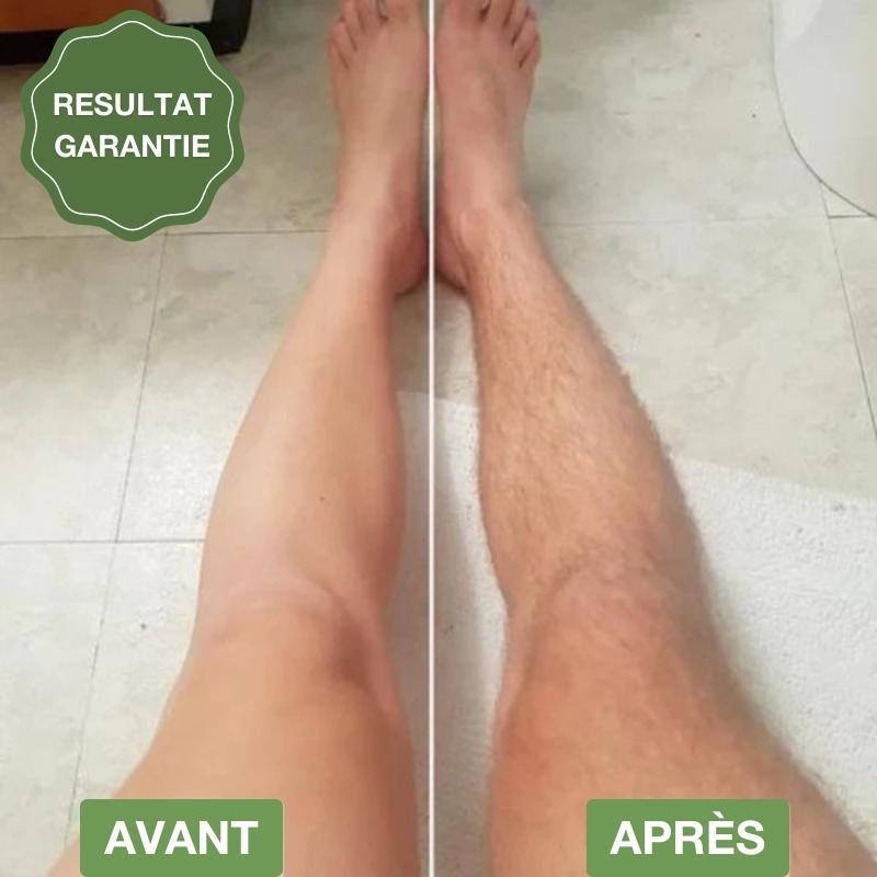 Rasoir de précision sans douleurs & irritations
