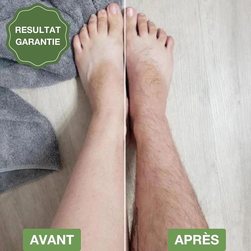 Rasoir de précision sans douleurs & irritations