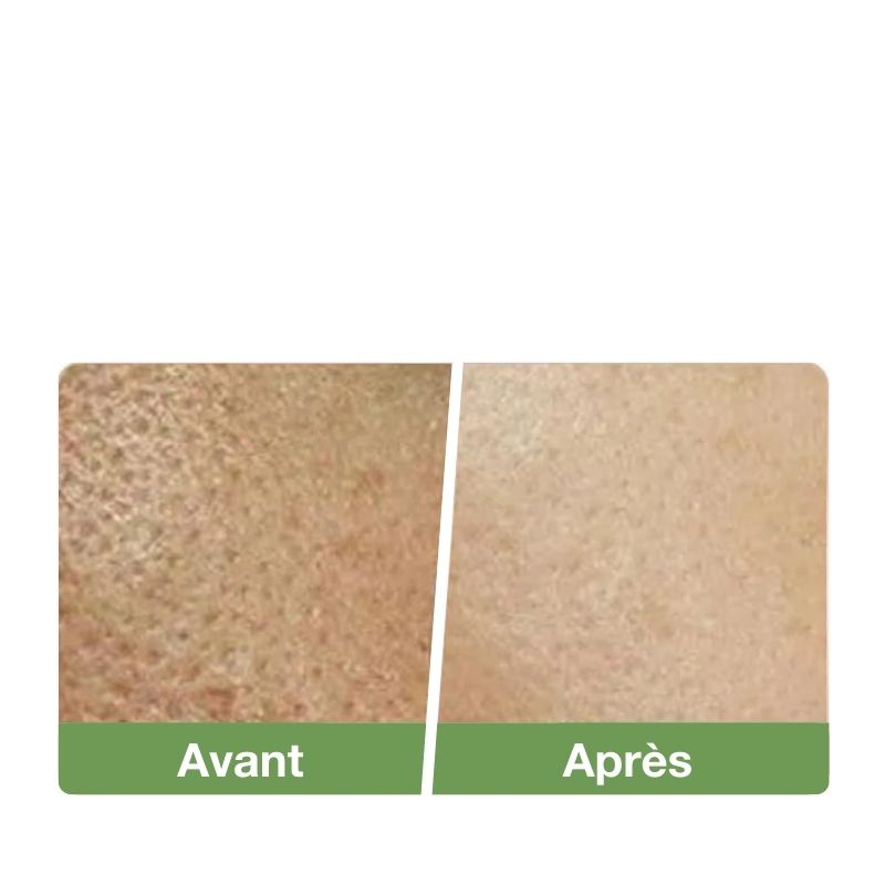 Épurateur de peau à ultrasons