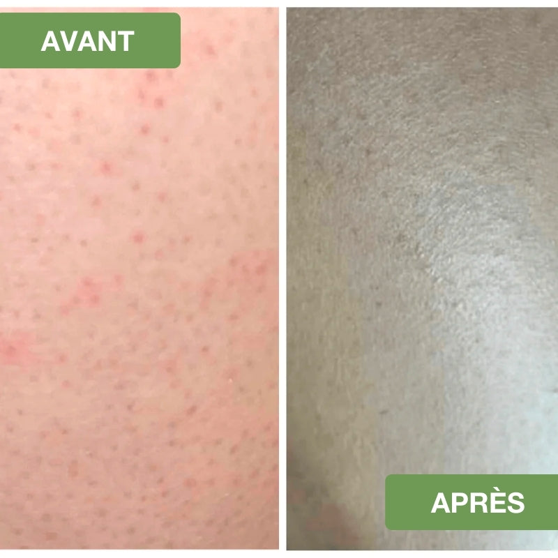Gant Exfoliant Premium - ÉclatNaturel™