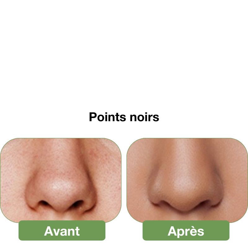 Brosse nettoyante pour le visage en silicone 2 en 1