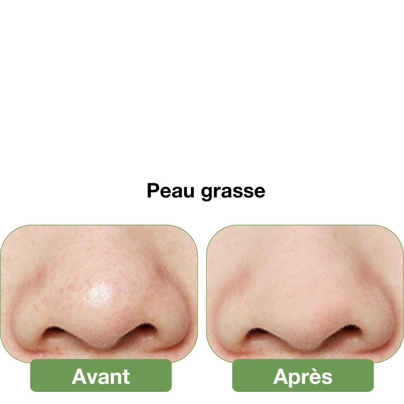 Brosse nettoyante pour le visage en silicone 2 en 1