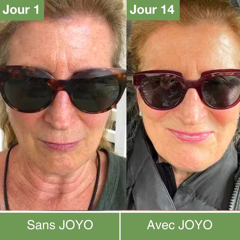 Masque LED Anti-âge & Rajeunissement