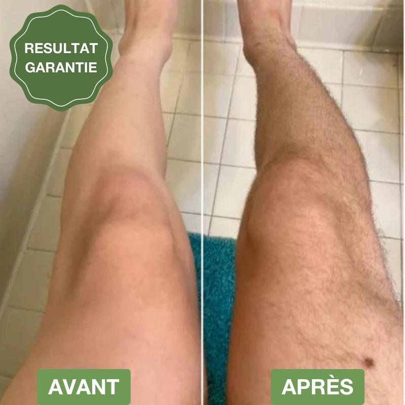 Rasoir de précision sans douleurs & irritations