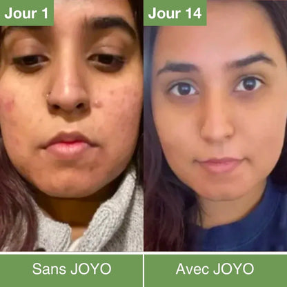 Masque LED Anti-âge & Rajeunissement