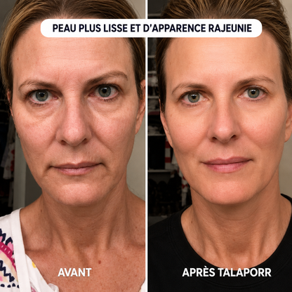 Le système de micro-infusion™