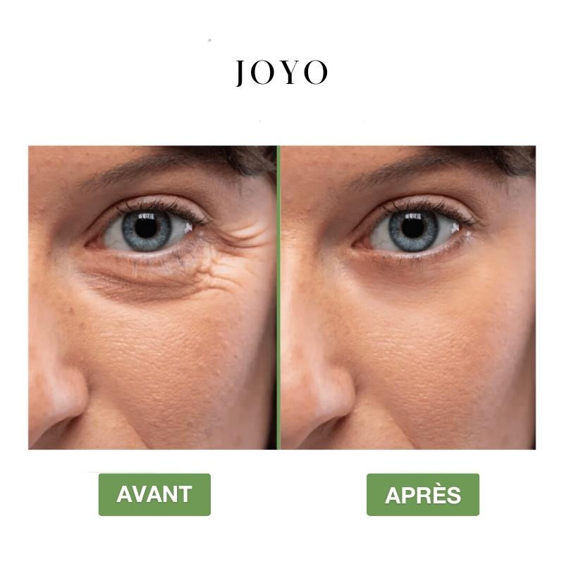 LumineLift™ Anti-Cernes Pro