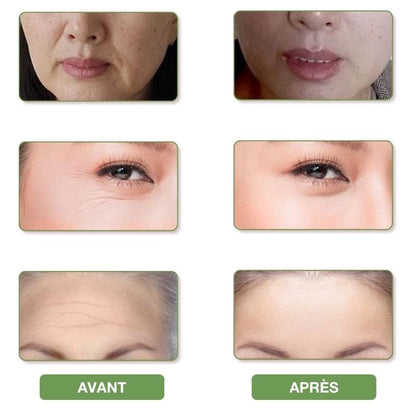 Barre Sculptante Vibrante pour le Visage