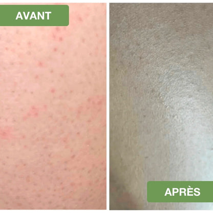 Gant Exfoliant Premium - ÉclatNaturel™
