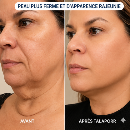 Le système de micro-infusion™