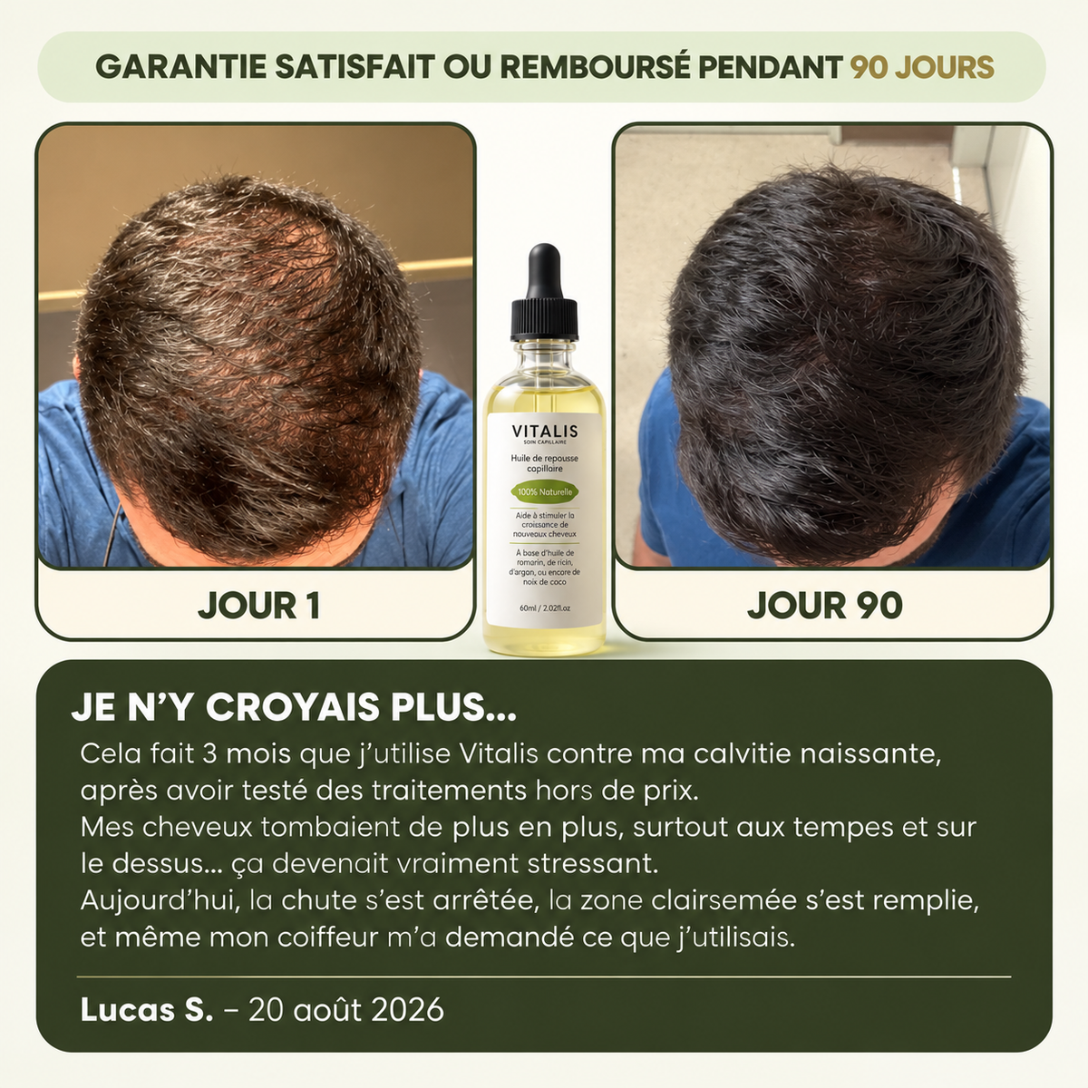 Vitalis® Sérum de Croissance Capillaire pour Hommes
