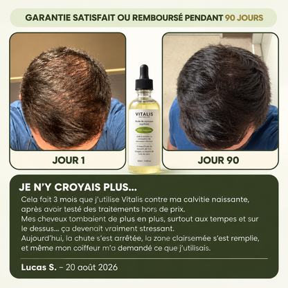 Vitalis® Sérum de Croissance Capillaire pour Hommes
