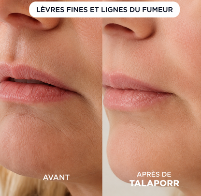 Le système de micro-infusion™